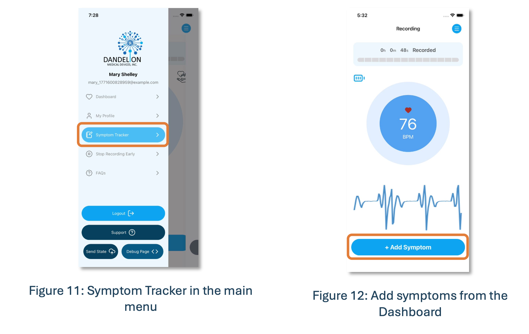 PulseTape symptom reporting